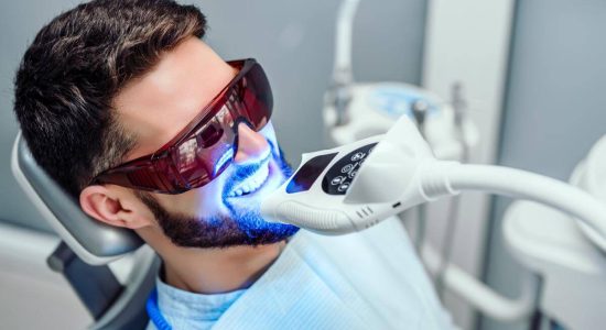Fastest-Ways-to-Whiten-Teeth